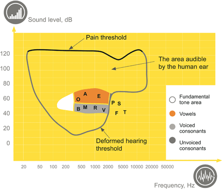 Deformed hearing